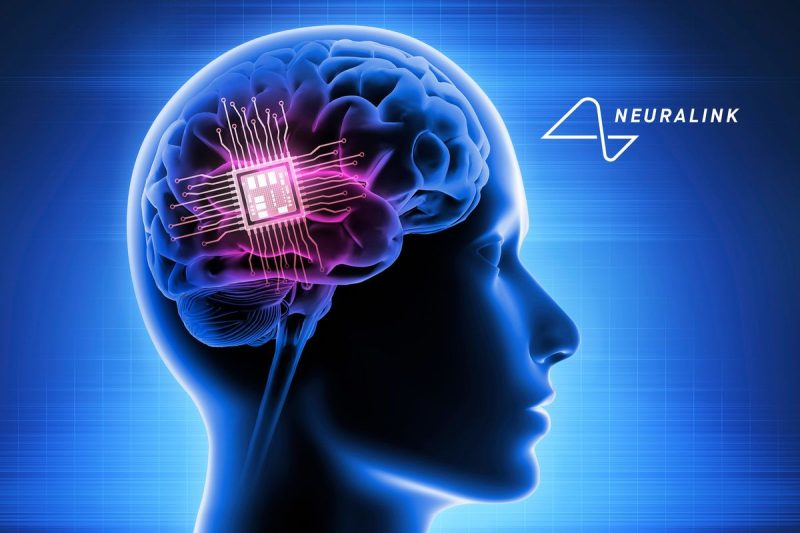  Can You Invest in Elon Musk’s Neuralink? (Updated 2024)