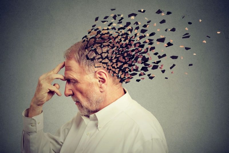  Alzheimer’s Disease Treatment Stocks: 3 Biggest NASDAQ Companies
